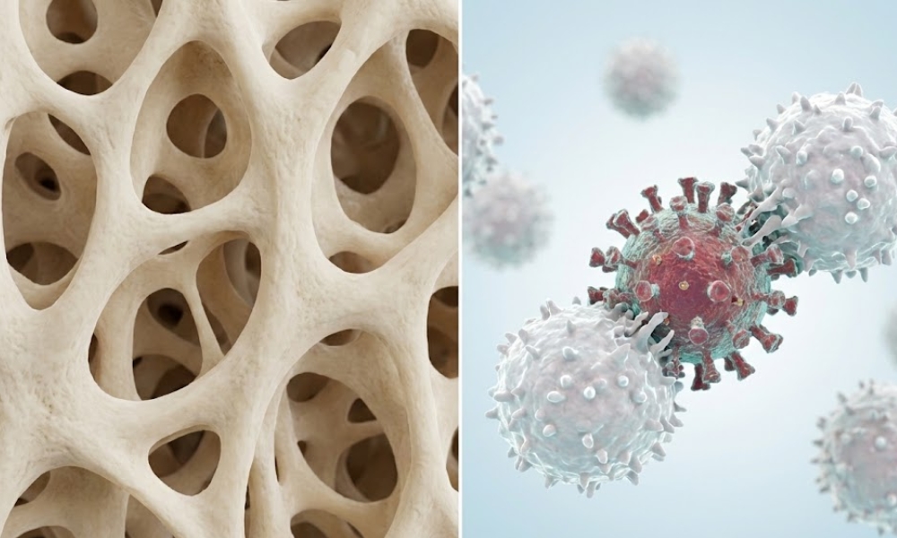 Vitamin D je ključan za zdravlje kostiju jer poboljšava apsorpciju kalcijuma i jača koštano tkivo